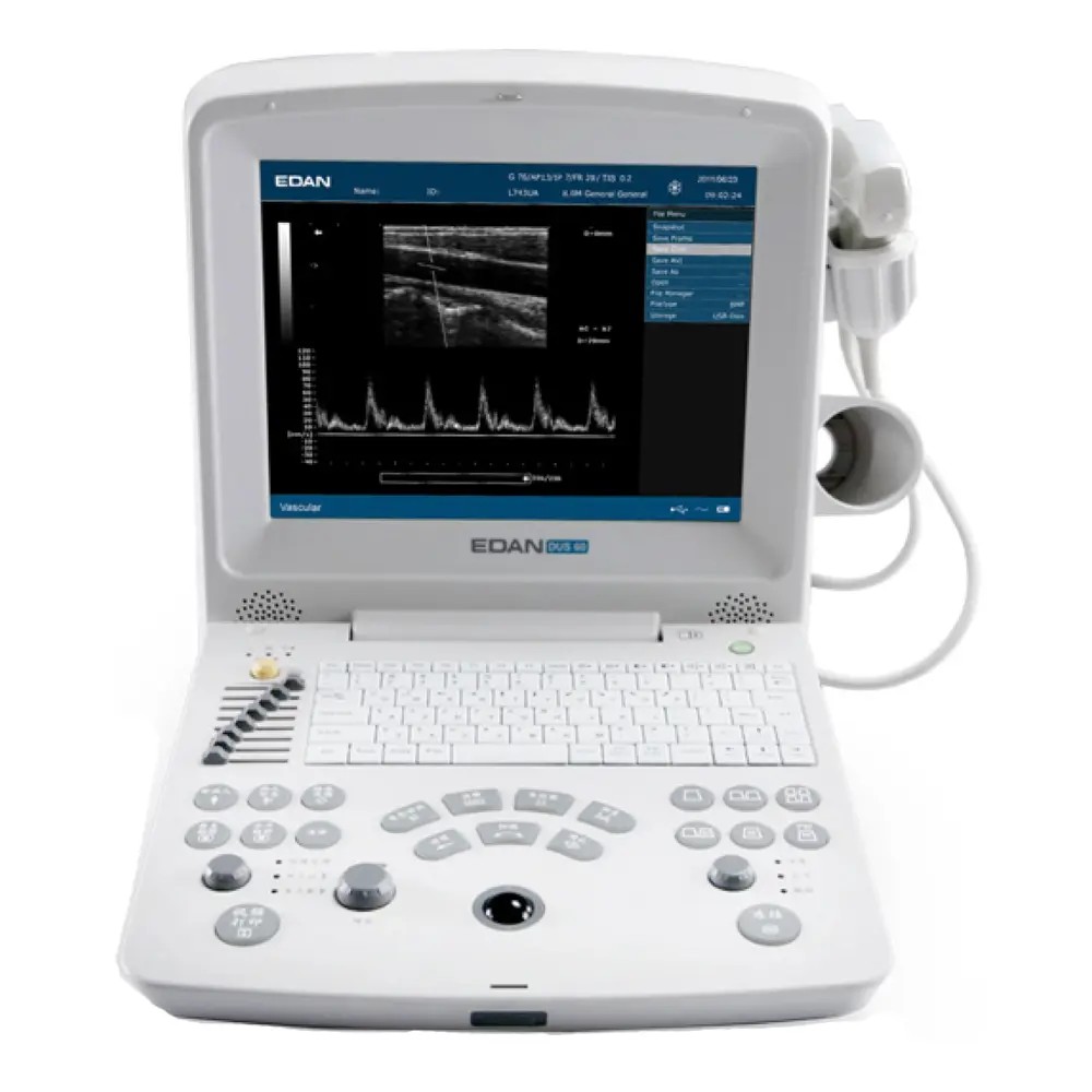 Ecógrafo Portátil Con Pantalla TFT-LCD a Color de12.1"  P/Humanos -Modelo: DUS-60H - EDAN | Stock: 3 - SAP: 194040005